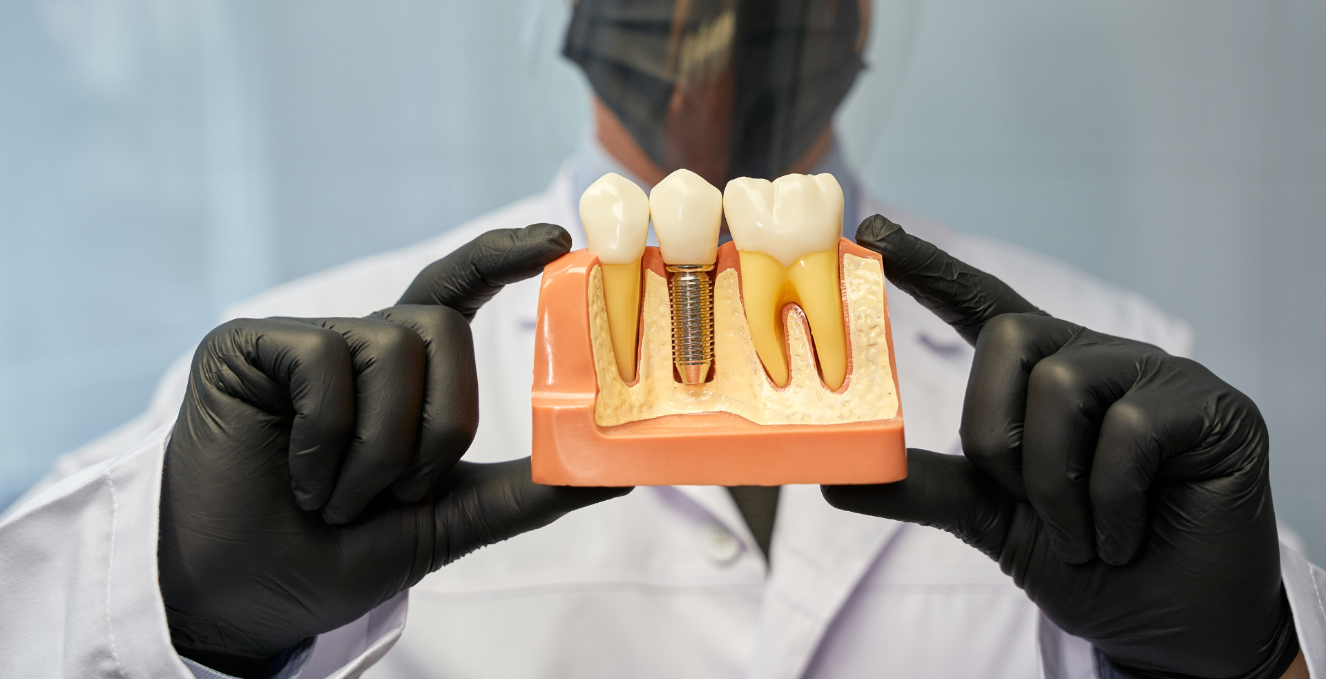 Implantes