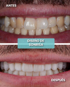AYD JUNIO 4-100 (1)