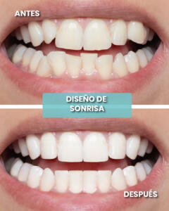 AYD JUNIO 5-100 (1)